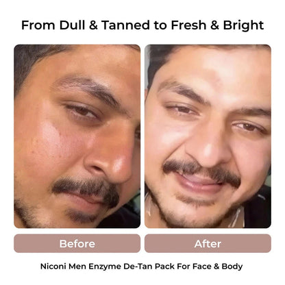 NICONI MEN Enzyme De-Tan Pack 🧴