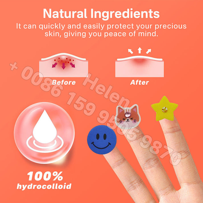 🌸 Pimple Patches – Effective Skincare 🌸