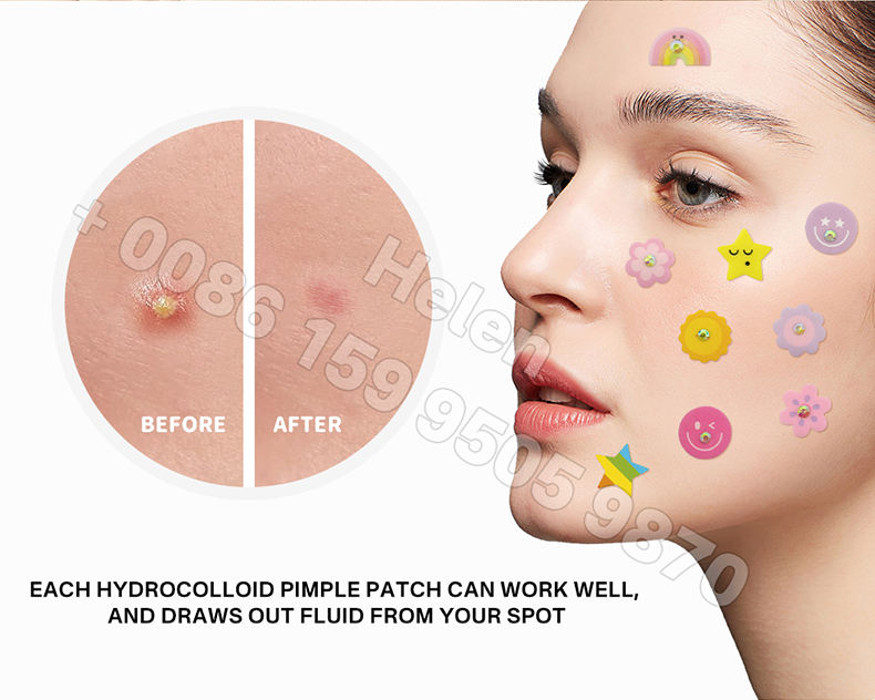 🌸 Pimple Patches – Effective Skincare 🌸