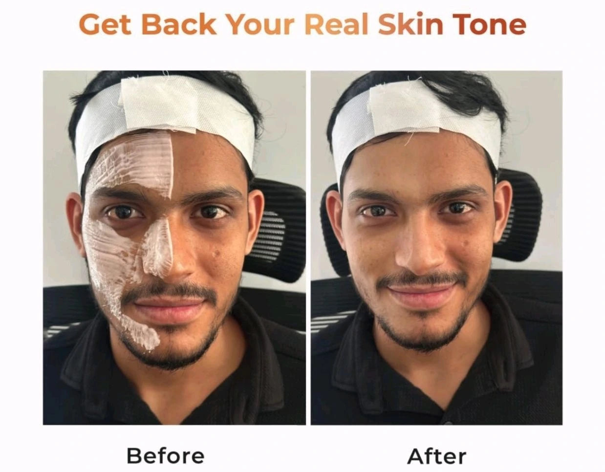 NICONI MEN Enzyme De-Tan Pack 🧴